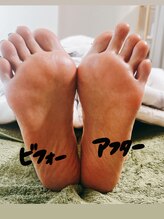 パール(pearl)/1回でも変わる足ゆる