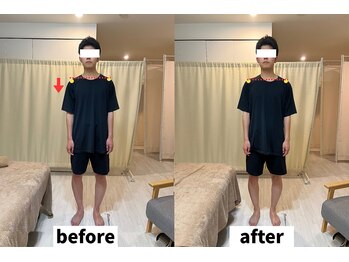ヘルシールーム 六本木7丁目店(Healthy room)/before/after【身体の歪み改善】