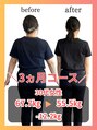 グレフル鍼灸接骨院 整体院 心斎橋 生活習慣や体質を変え、リバウンドしない健康で美しい身体を作る