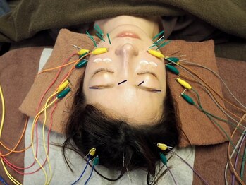 ビハダ(BIHADA)/人気NO.1の微弱電流美容鍼☆彡