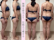 プラスワンビューティテン 新大阪店(Plus One Beauty)の雰囲気（痩身施術効果：ダイエット/脂肪燃焼/疲労回復/むくみ/引き締め）