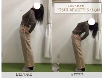 小顔×姿勢改善 KISHI BEAUTY SALON/【姿勢改善・猫背・巻き肩】