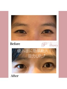 ピオニー(Peony)/Before & After