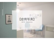 ベル 横浜(Belle)/お客様のBefore｜After