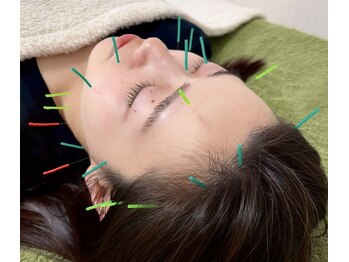 チキバンビューティーサロン/美容鍼で小顔リフトアップ♪