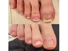シーネイル(C Nail)の雰囲気（【フットケア】たった一回でここまでキレイに♪）
