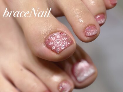 ブレスネイル(brace Nail)の写真