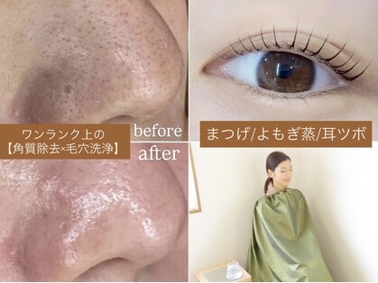 タイズレリーフ(TIES RELIEF)の写真