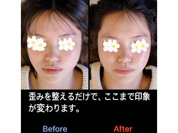 美容矯正サロン レレポノ(LELEPONO)/