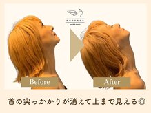 ラフリー 神戸三宮院(RUFFREE)/首の可動域にも【肩甲骨はがし】