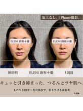 エレーニ 麻布十番(ELENI)/毛穴×頭蓋骨小顔矯正｜加工なし