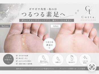 コッタ ホリエ(Cotta. horie)の写真/足裏のトラブルでお悩みな方!フットケア理論検定指導員が対応!◎フットバス付きで大人気★