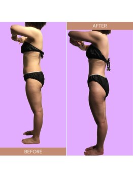 サンテボーテ(Sante Beaute)/集中ダイエットコース