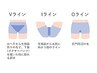 【都度払い】IO脱毛セット（Vライン除く）¥5200→¥3800
