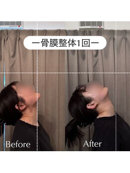 アイミーボーテ(Aime beaute)/骨膜整体