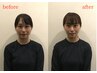 【結果重視・大好評◎徹底究極/根本改善】　小顔ケア　¥5,500→￥4,980