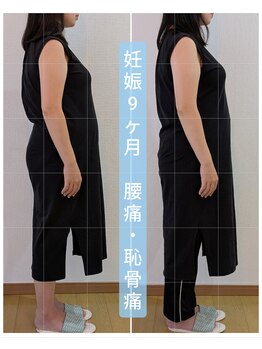 ポノ(Pono)/マタニティ整体