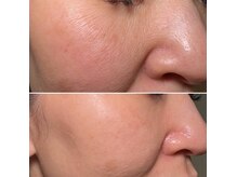 グラチア(Gratiae)の雰囲気（50代/3ヶ月6回たるみ改善美肌フェイシャルコース）