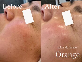 サロンドボーテ オランジュ(salon de beaute Orange)/タラソトリートメント1回