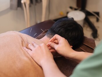 繁内鍼灸治療院の写真/【鍼灸×整体のWケア】「もう仕方ない」とあきらめていた首肩のつらさを、根本から改善しませんか?