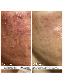 リレフー(Relafy)/諦めないで