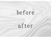 整骨院トリデ(整骨院TORIDE)/before　after