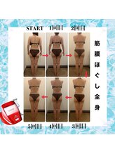 エステサロンラグジューム/筋膜リリース全身