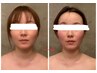 【リフトアップ！たるみケアに】EMSによる顔筋トレーニングコース60分
