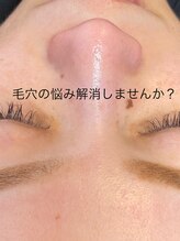 ラナ(Lana)/今話題の毛穴エクストラクション