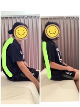 いおり骨盤整体 リブート(RE:BOOT)/姿勢矯正ビフォーアフター