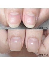 プライベートネイルサロン ママネイル(mamanail)/最強のネイルケア★お客様症例