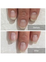 サラ(Sarah.)/深爪ケアメニュー