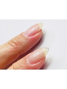 爪の悩みを解消できる（ケア含む）