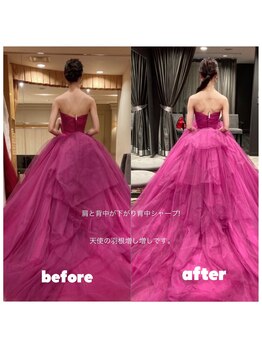 美容矯正専門サロン アカデミア(ACADEMIA)/花嫁様before after