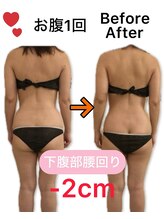 アフリオーラ はなみずき店(affriolant)/ビフォーアフター