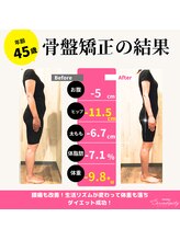 セレンディピティ 刈谷店(Serendipity)/【美容骨盤矯正】痩身ダイエット