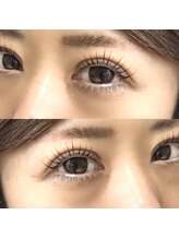 ハセミキ(Hase Miki)/アップフォースリフト（まつパ）