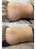 【特にお腹が気になる方】便秘改善+サイズダウンで本格痩身　60分¥20625→