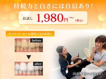 ホワイトニングセンター 長野駅前店