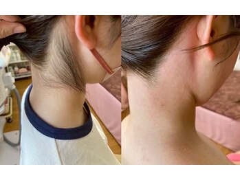 ティンク(Tink)/うなじワックス☆Before→After