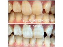 ホワイトニングルーム 横浜店(Whitening Room)/セルフホワイトニング/横浜