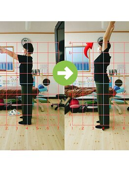 サプライズ整体院/30代ママさんの肩こり初回結果