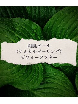 ブラックボックス(BLACK BOX)/