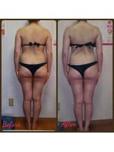 ダイエットルーム リ ボーヌ(Re Bornu)/・30代　全身メディセル8回