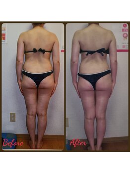 ダイエットルーム リ ボーヌ(Re Bornu)/・30代 全身メディセル8回