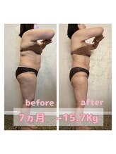 サロン ド フェイス モアナ(Salon de Faith Moana)/キャビテーション痩身【50代】