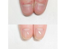 ルクレール カシェット(Le clair cachette)の雰囲気（むしり癖から自爪育成で指先までも潤いある指先に！）