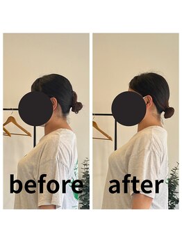 熊本カワル整体 JR上熊本駅院/首・肩こり