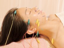 ヨンビ/美容鍼も体メンテナンスもお任せ