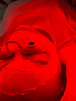 ハロースック 六本木(Hellossook)/お肌のシミケアレーザー